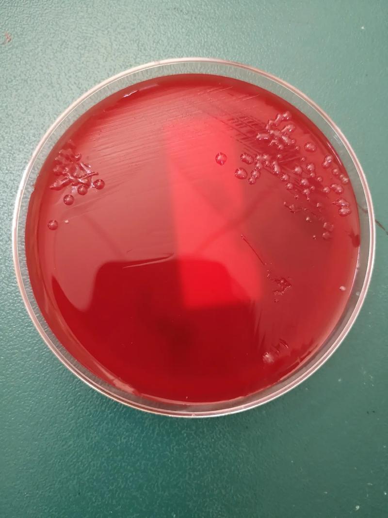 抗生素抑制现象,原始区没有细菌生长,非原始区由于药物浓度降低